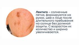 Чем вывести пот: эффективные методы и средства в Зарина