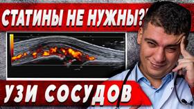 Сосуды забиты на 70%: что делать в Зарина